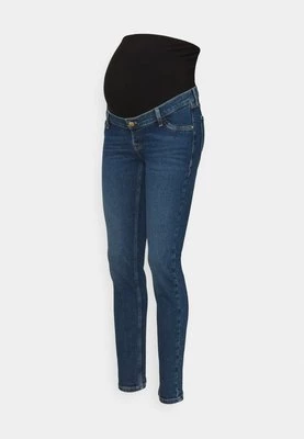 Jeansy Skinny Fit Anna Field MAMA