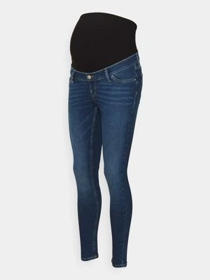 Jeansy Skinny Fit Anna Field MAMA