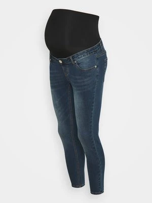 Jeansy Skinny Fit Glamorous Bloom