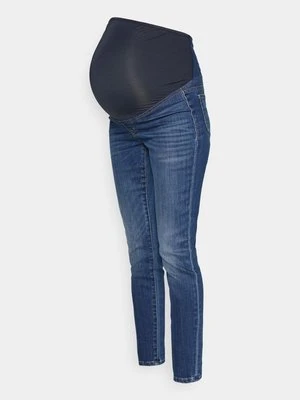 Jeansy Skinny Fit Madewell