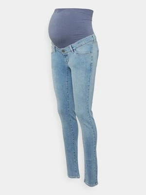 Jeansy Skinny Fit Noppies