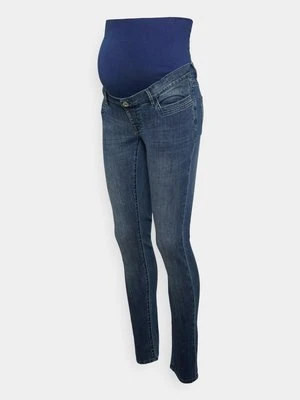 Jeansy Skinny Fit Supermom