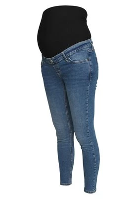 Jeansy Skinny Fit Topshop Maternity