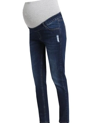 Jeansy Slim Fit bellybutton
