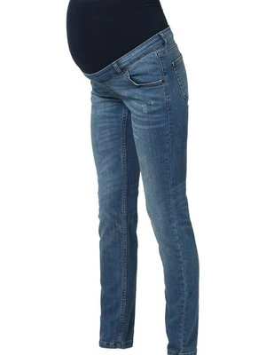 Jeansy Slim Fit bellybutton