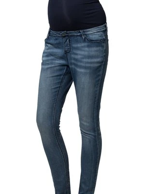 Jeansy Slim Fit Noppies