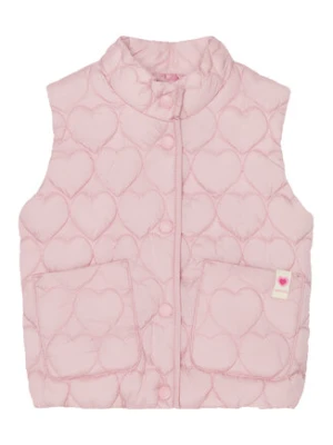 United Colors Of Benetton Kamizelka 2YCUGJ00L Różowy Regular Fit